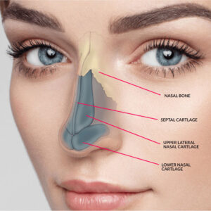 Septoplasty