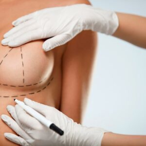 Mammoplasty and lift