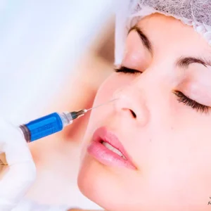 rhinoplasty
