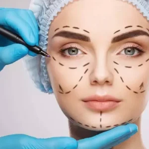cheek prosthesis