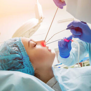 Sinus endoscopy