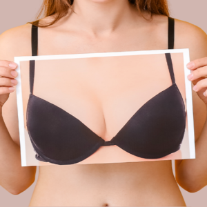 Bilateral reconstruction mastectomy