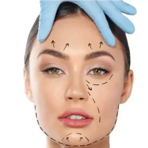 eyebrow lift