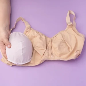 Mastopexy and breast prosthesis