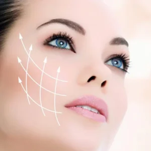 face lift